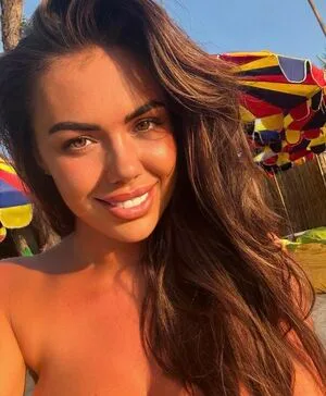 Chessxx OnlyFans Leaked Free Thumbnail Picture - #Dvfh55YMT0