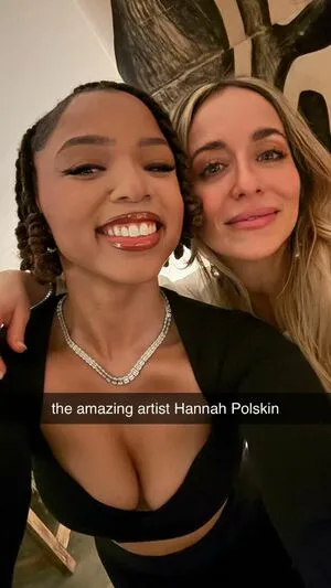 Chloe Bailey OnlyFans Leaked Free Thumbnail Picture - #PufVSdDFBq