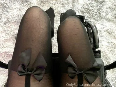 Chrissycantwalk OnlyFans Leaked Free Thumbnail Picture - #1rmFPk5aCe
