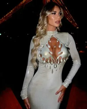 Christine McGuinness OnlyFans Leaked Free Thumbnail Picture - #PrsHwGkdIA