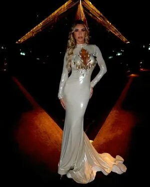 Christine McGuinness OnlyFans Leaked Free Thumbnail Picture - #xep2EIYNrS
