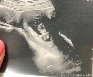 cutegiraffe OnlyFans Leaked Free Thumbnail Picture - #xEGXOVjQig