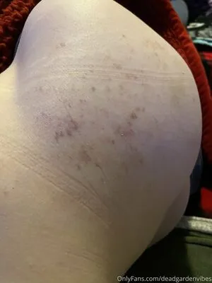 Deadgardenvibes OnlyFans Leaked Free Thumbnail Picture - #ET85VYjEMS