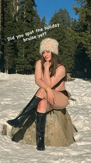 Demurelixir OnlyFans Leaked Free Thumbnail Picture - #03WbqrqP2R