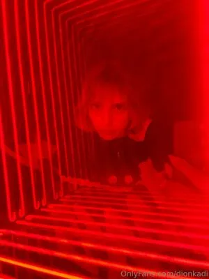 Dionkadi OnlyFans Leaked Free Thumbnail Picture - #UOGzfIBJ2S