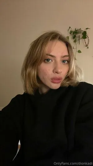 Dionkadi OnlyFans Leaked Free Thumbnail Picture - #V1Px6XZ1fG