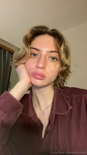 Dionkadi OnlyFans Leaked Free Thumbnail Picture - #b67Ryghsua