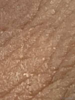 Dissatoes OnlyFans Leaked Free Thumbnail Picture - #vyyOMVEyx5