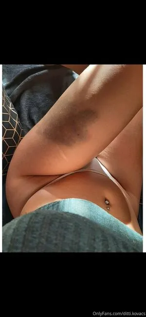 Ditti Kovacs OnlyFans Leaked Free Thumbnail Picture - #Bm4IgThrsn