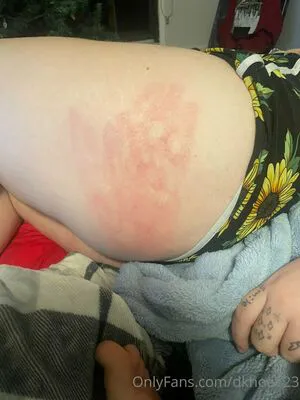 Dkhoe123 OnlyFans Leaked Free Thumbnail Picture - #BMuNTq2Tvl