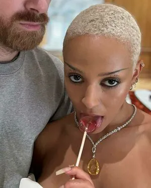 Doja Cat OnlyFans Leaked Free Thumbnail Picture - #4ZlLtp4iE7