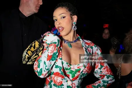 Doja Cat OnlyFans Leaked Free Thumbnail Picture - #Gq0W69rLaR