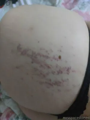 Doktorstoned OnlyFans Leaked Free Thumbnail Picture - #JyDfSeWKus