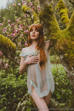 Doyoulikefreckles OnlyFans Leaked Free Thumbnail Picture - #K6zJbXOMpj