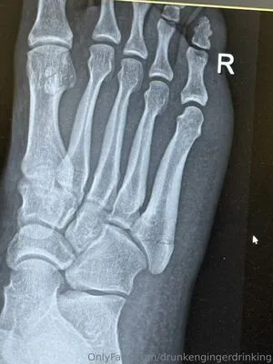 Drunkengingerdrinking OnlyFans Leaked Free Thumbnail Picture - #r8tNeEOzty