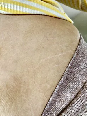 Eatee OnlyFans Leaked Free Thumbnail Picture - #qYHi7HPLUo