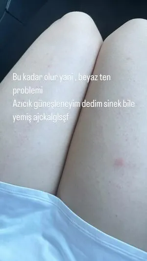 Ecbsnn Ece Basaran OnlyFans Leaked Free Thumbnail Picture - #hOxNWKiFkT