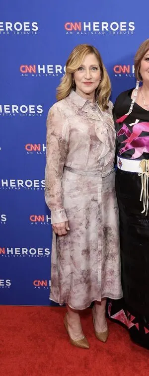 Edie Falco OnlyFans Leaked Free Thumbnail Picture - #eccgBeg9qE