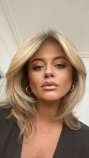 Emily Atack OnlyFans Leaked Free Thumbnail Picture - #1VHO6QS6AY