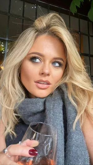 Emily Atack OnlyFans Leaked Free Thumbnail Picture - #4qin2YtXoX