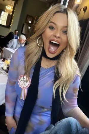 Emily Atack OnlyFans Leaked Free Thumbnail Picture - #CnWMiCYBcA