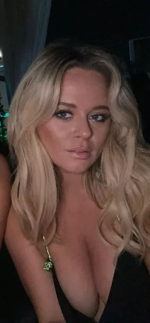 Emily Atack OnlyFans Leaked Free Thumbnail Picture - #DErpb3bdvN