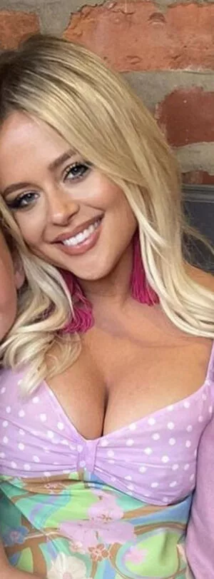 Emily Atack OnlyFans Leaked Free Thumbnail Picture - #DIxccOJQ7L