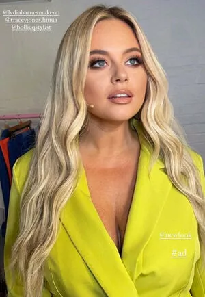 Emily Atack OnlyFans Leaked Free Thumbnail Picture - #FhXzolMveC