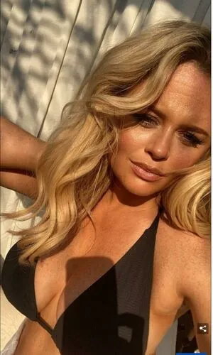Emily Atack OnlyFans Leaked Free Thumbnail Picture - #Fuy5zsJMzB