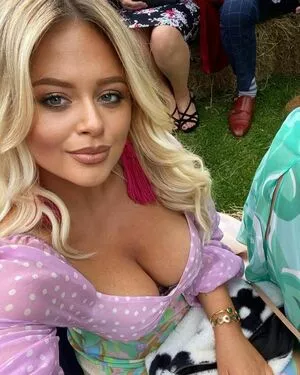 Emily Atack OnlyFans Leaked Free Thumbnail Picture - #JixuY4tkHi