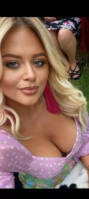 Emily Atack OnlyFans Leaked Free Thumbnail Picture - #LZIhGvtrD6