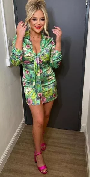 Emily Atack OnlyFans Leaked Free Thumbnail Picture - #NaNsEJVVhZ