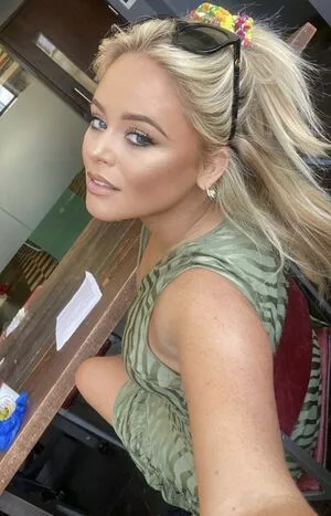 Emily Atack OnlyFans Leaked Free Thumbnail Picture - #ScKvlEvy6B