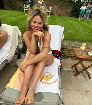 Emily Atack OnlyFans Leaked Free Thumbnail Picture - #fm5dLStyzS