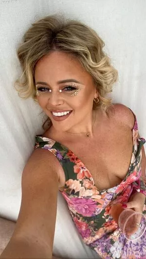 Emily Atack OnlyFans Leaked Free Thumbnail Picture - #pGKWAZD7YM