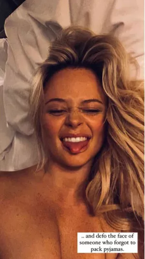 Emily Atack OnlyFans Leaked Free Thumbnail Picture - #rwgC9MWALC