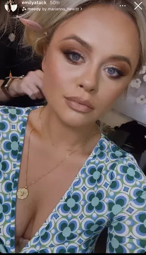 Emily Atack OnlyFans Leaked Free Thumbnail Picture - #sK6ywihVjA