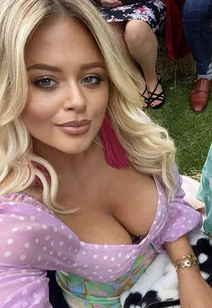 Emily Atack OnlyFans Leaked Free Thumbnail Picture - #vZaIiimH5d