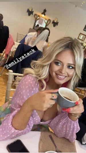 Emily Atack OnlyFans Leaked Free Thumbnail Picture - #xFe4BPzHaH