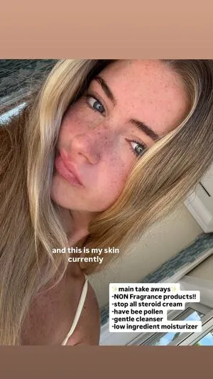 Emma Burnze OnlyFans Leaked Free Thumbnail Picture - #3EeP84KDSp