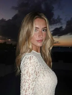 Emma Burnze OnlyFans Leaked Free Thumbnail Picture - #LRi3bYMflU