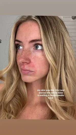 Emma Burnze OnlyFans Leaked Free Thumbnail Picture - #NFeI8sy38j