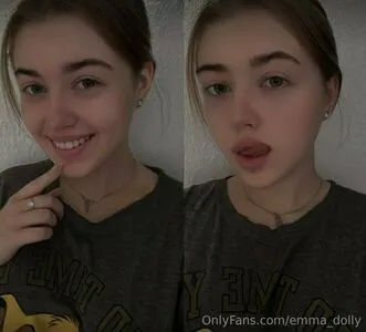 Emma Dolly OnlyFans Leaked Free Thumbnail Picture - #5N40GerLPy