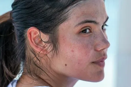 Emma Raducanu OnlyFans Leaked Free Thumbnail Picture - #Il1KfYMwAI