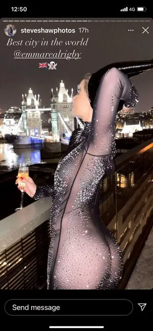 Emma Rigby OnlyFans Leaked Free Thumbnail Picture - #W4KN4XK3OJ