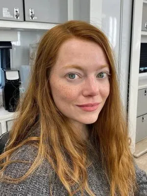 Emma Stone OnlyFans Leaked Free Thumbnail Picture - #x8eARVGeee