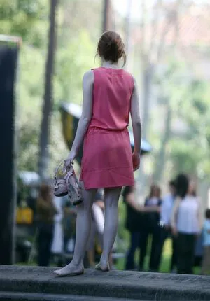 Emma Stone OnlyFans Leaked Free Thumbnail Picture - #0AsJTL0Giv