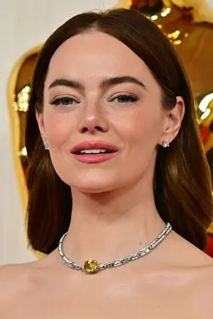 Emma Stone OnlyFans Leaked Free Thumbnail Picture - #AFAW3nD8ko