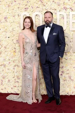 Emma Stone OnlyFans Leaked Free Thumbnail Picture - #oHGKXUo6Fl