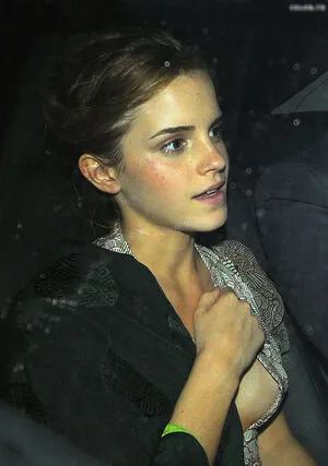 Emma Watson OnlyFans Leaked Free Thumbnail Picture - #ta7xoBw6jg